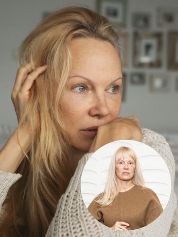 Pamela Anderson: Έκανε αφέλειες και είναι μία άλλη 2