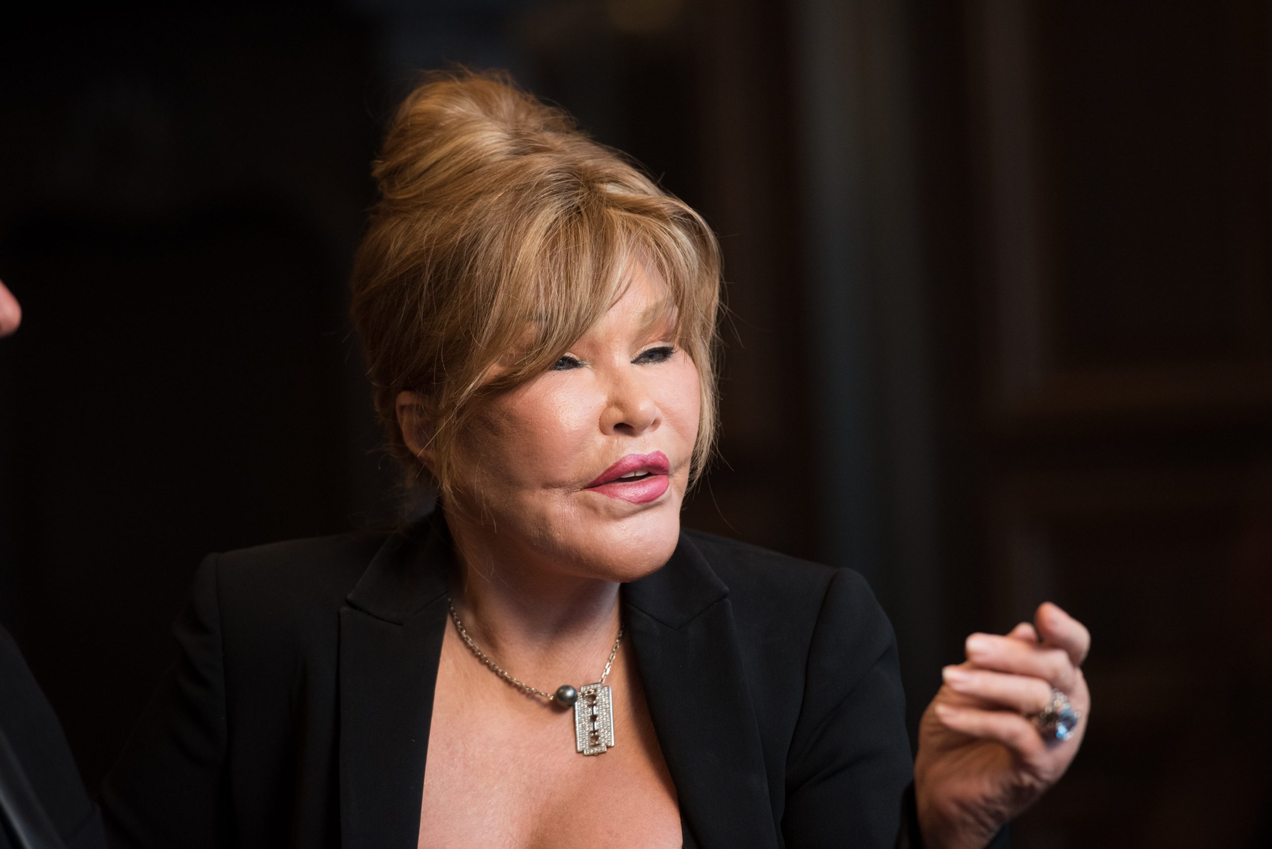 Jocelyn Wildenstein: Η ζωή, η μεταμόρφωση και ο θάνατος της «Catwoman» που πέθανε στα 84 χρόνια 1