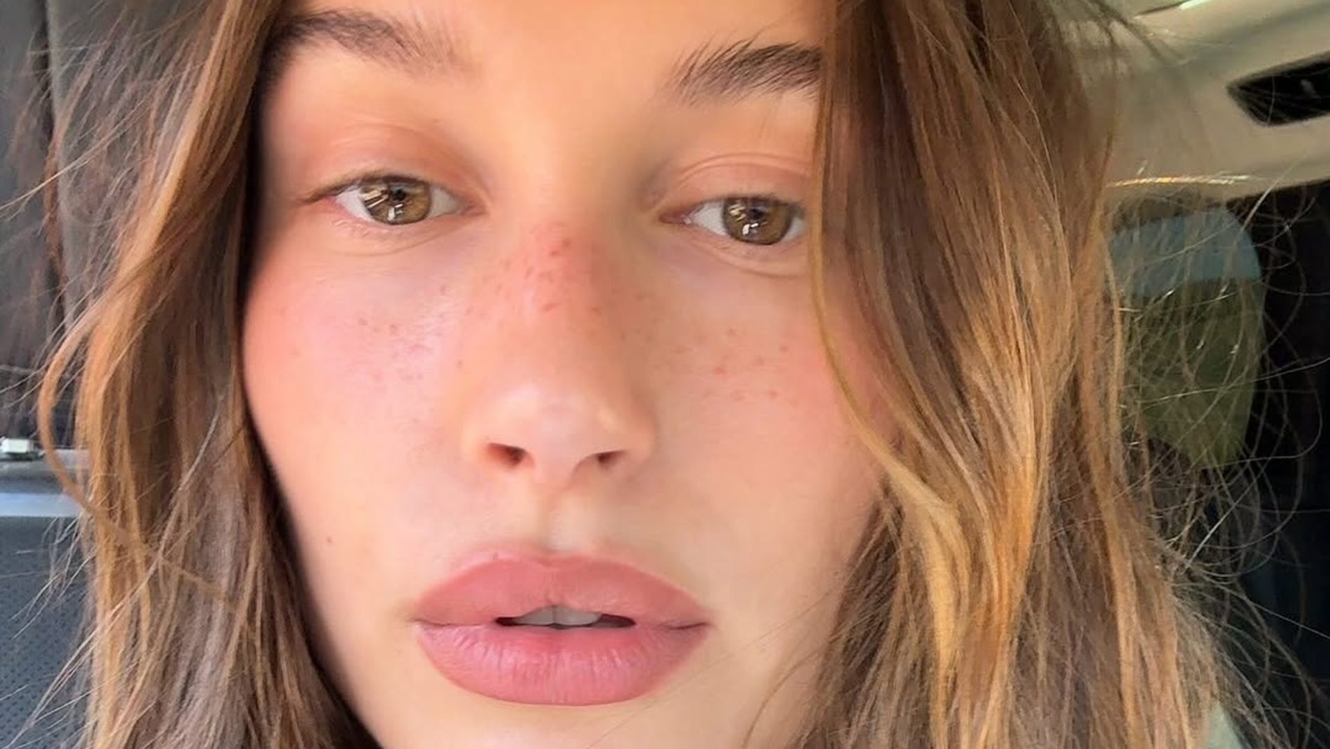 Πρήξιμο στο πρόσωπο; 6 τρόποι για να το καταπολεμήσετε 1