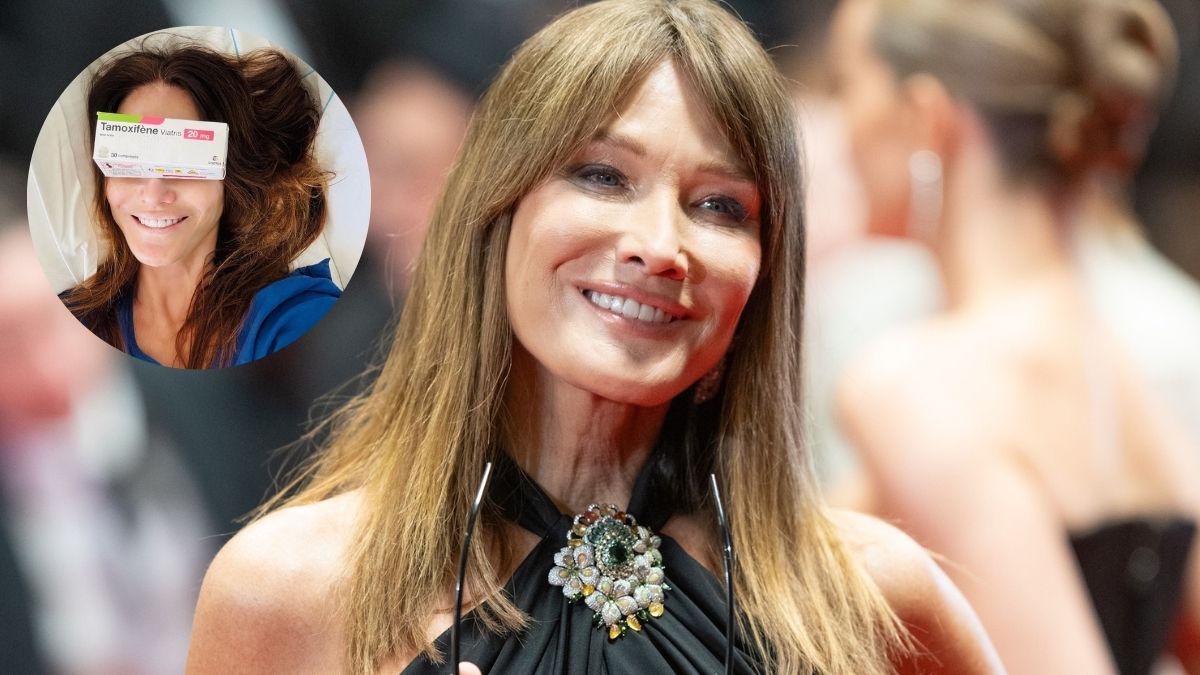 Carla Bruni: Ολοκλήρωσε τη θεραπεία για τον καρκίνο του μαστού – Πέντε χρόνια μάχης και το μήνυμα ζωής