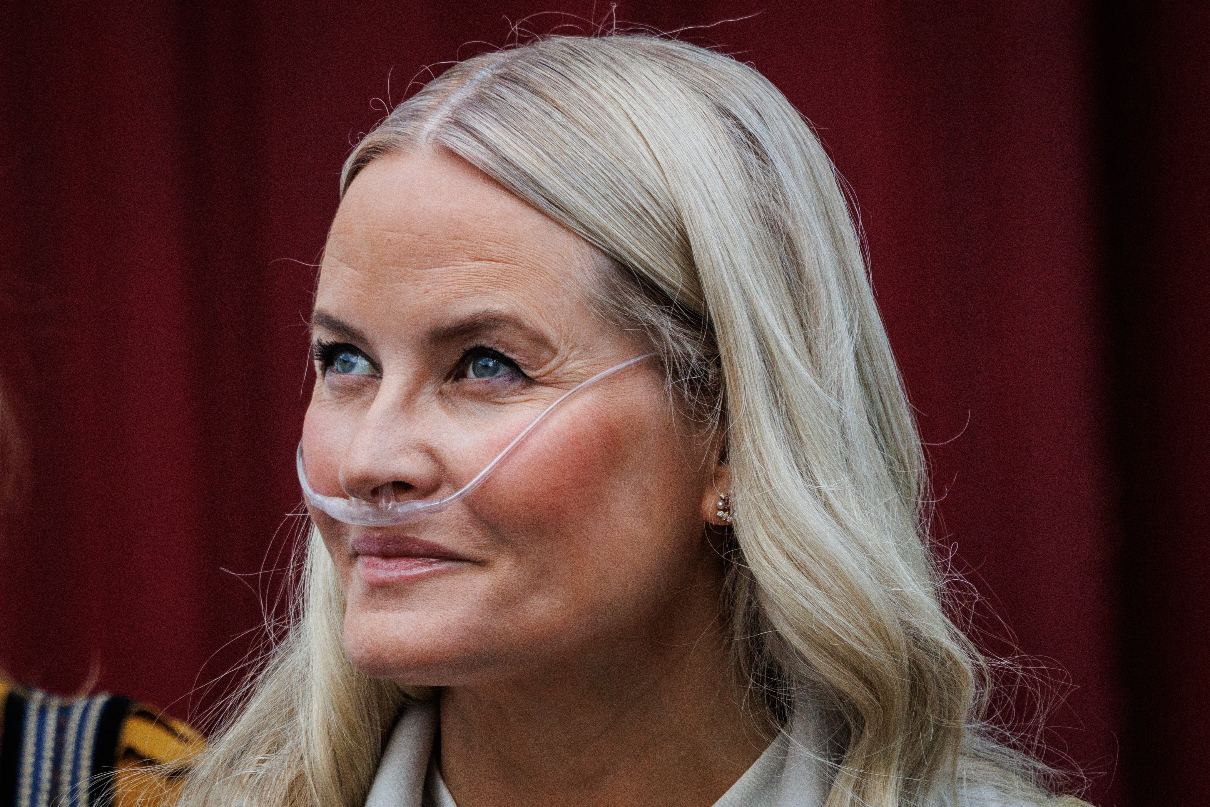 Mette-Marit: Μπήκε σε λίστα αναμονής για μεταμόσχευση πνεύμονα – Τι ανακοίνωσε το Παλάτι
