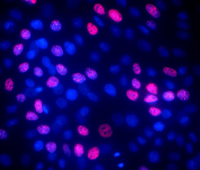 Τα νέα βλαστικά κύτταρα | tovima.gr
