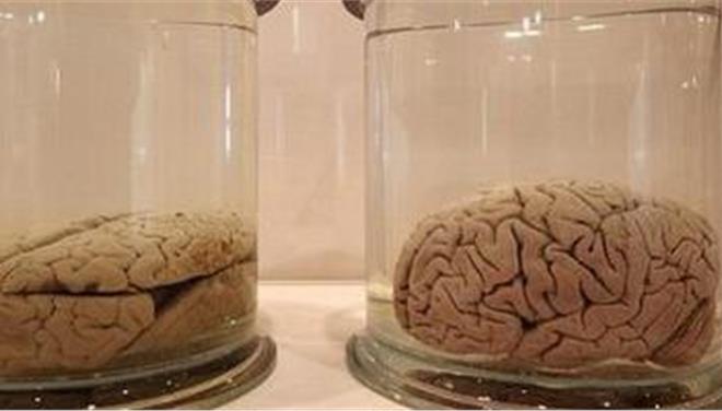 ΗΠΑ:Εκλεψε διατηρημένους ανθρώπινους εγκεφάλους από μουσείο