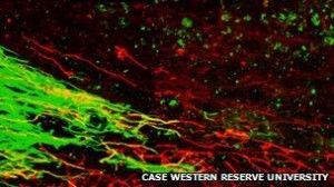 Αναγέννηση των νευρικών κυττάρων σε παράλυτα ζώα