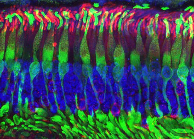 Προς (βλαστοκυτταρική) αναστροφή της τύφλωσης