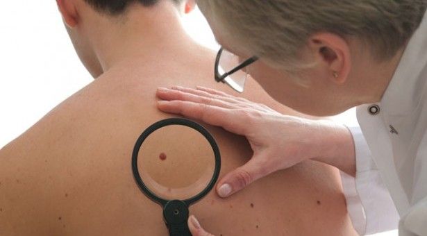 Η πρώτη δραστική θεραπεία για το μελάνωμα