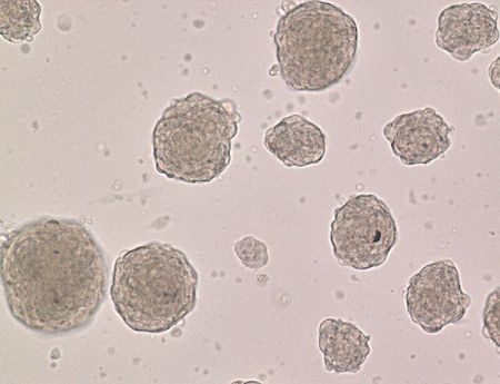 Η νέα βλαστοκυτταρική «συνταγή» εφαρμόστηκε σε ανθρώπινα κύτταρα