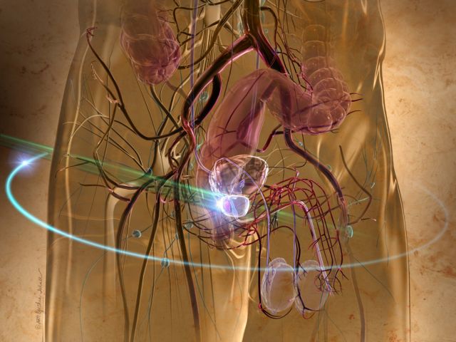 Προς γενετικό τεστ για τον καρκίνο του προστάτη