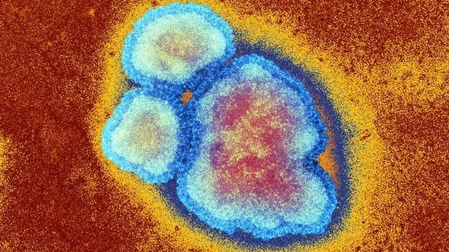 Ο ιός της ιλαράς θεραπεία για τον καρκίνο | tovima.gr