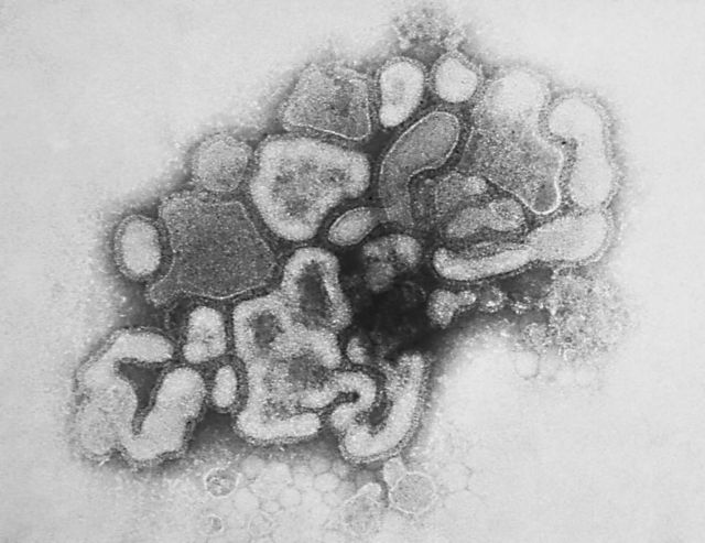 «Ανέστησαν» τον φονικό ιό της γρίπης του 1918