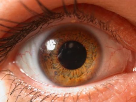 Αναγέννησαν ανθρώπινο κερατοειδή χιτώνα