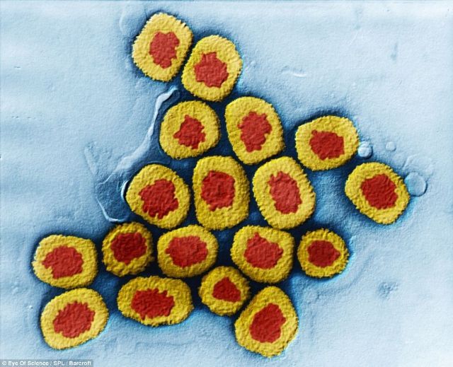 Βρέθηκαν ξεχασμένα φιαλίδια με τον θανατηφόρο ιό της ευλογιάς