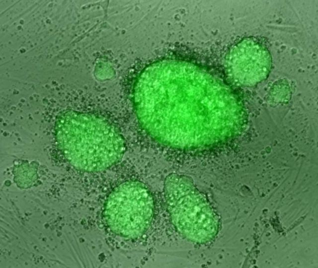 Νέα αποτελεσματικότερη μέθοδος δημιουργίας βλαστοκυττάρων