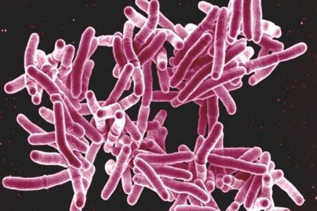 Το πρώτο τεστ αναπνοής για τη φυματίωση