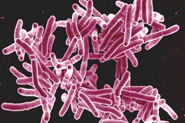 Το πρώτο τεστ αναπνοής για τη φυματίωση