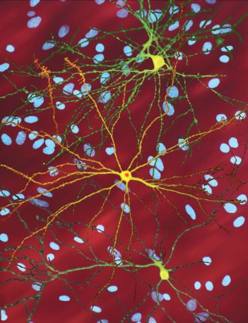 «Αλχημεία» μετατρέπει κύτταρα του δέρματος σε νευρώνες | tovima.gr