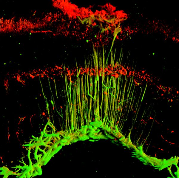Τα κύτταρα «οπτικές ίνες» που μας χαρίζουν την έγχρωμη όραση