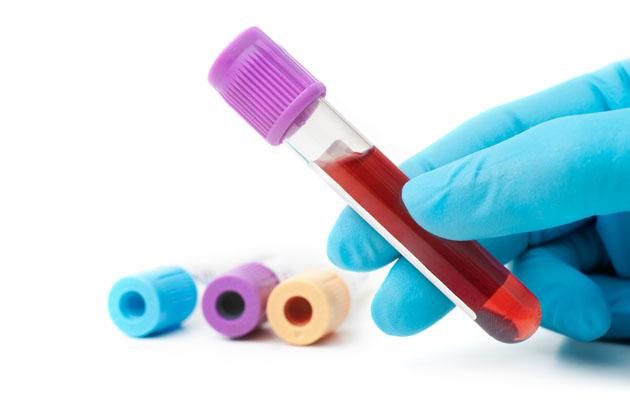 Ετήσιο τεστ αίματος για τον καρκίνο των ωοθηκών «ψαλιδίζει» τους θανάτους | tovima.gr