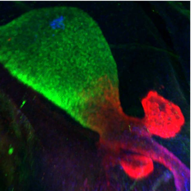 Στομάχια εργαστηρίου παράγουν ινσουλίνη