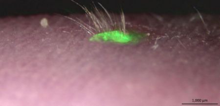 Τεχνητό δέρμα παράγει τρίχες!