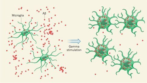 LED εναντίον Αλτσχάιμερ