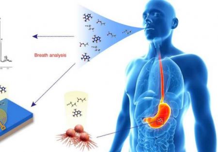 Τεστ αναπνοής ανιχνεύει τον καρκίνο