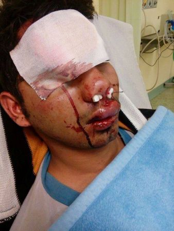 Νέα επίθεση σε εργάτη από το Πακιστάν στον Ασπρόσπυργο