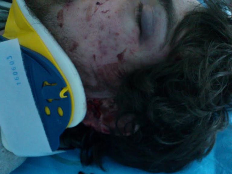 Δολοφονική επίθεση αγνώστων σε φοιτητή | tovima.gr
