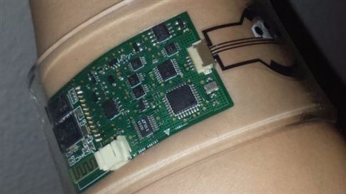 Αισθητήρας ιδρώτα για διάγνωση της κυστικής ίνωσης