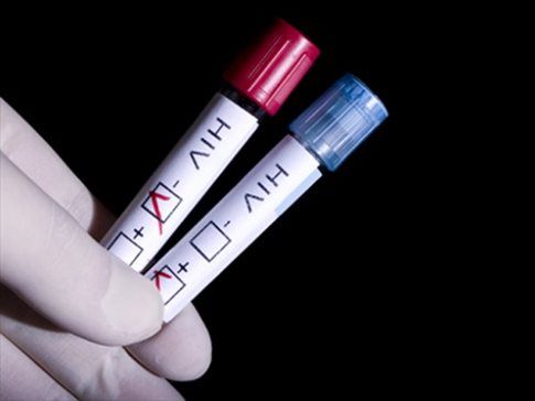 Γρήγορο τεστ ανιχνεύει τον ιό HIV ακόμα και σε λανθάνουσα κατάσταση