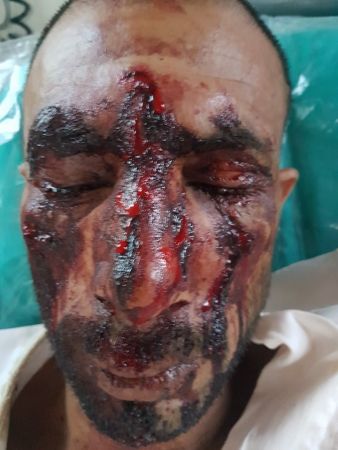 Δολοφονική επίθεση κατά μεταναστών στον Ασπρόπυργο