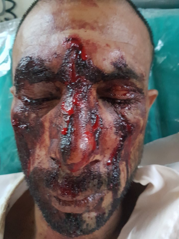 Δολοφονική επίθεση κατά μεταναστών στον Ασπρόπυργο