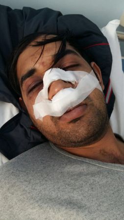 Νέα φασιστική επίθεση σε μετανάστη εργαζόμενο στη Λαμπρινή