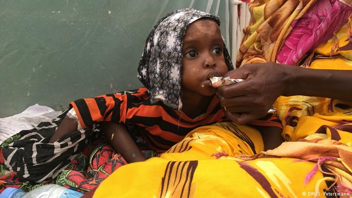 Εκθεση της Welthungerhilfe: Οι ανισότητες πυροδοτούν  υποσιτισμό
