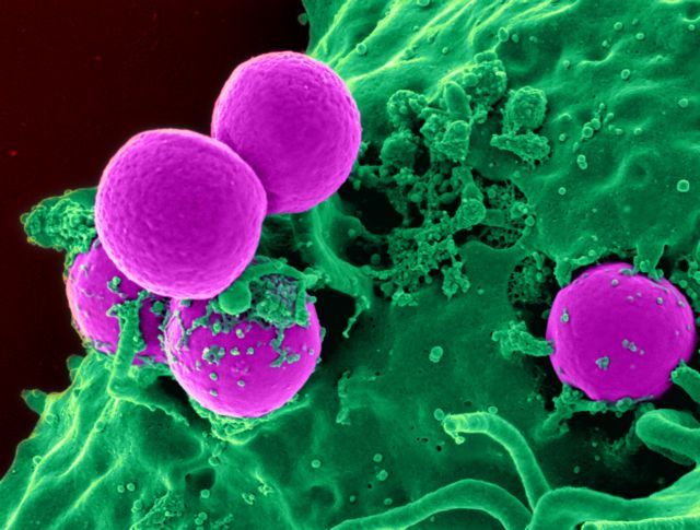 Λίφτινγκ σε αντιβιοτικό σκοτώνει υπερβακτήρια