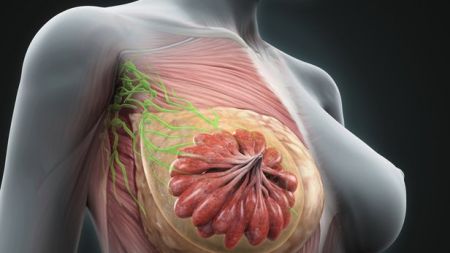 Καρκίνος μαστού: Διπλή «επίθεση» εξολοθρεύει τα καρκινικά κύτταρα