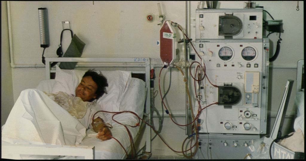 ΕΛ.ΑΣ : Ερευνώνται 20 κλοπές ιατρικών μηχανημάτων σε Ευρώπη και ΗΠΑ