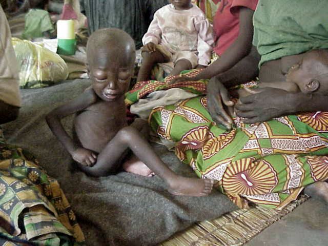 Η «αόρατη πείνα» πλήττει δύο δισεκατομμύρια ανθρώπους | tovima.gr