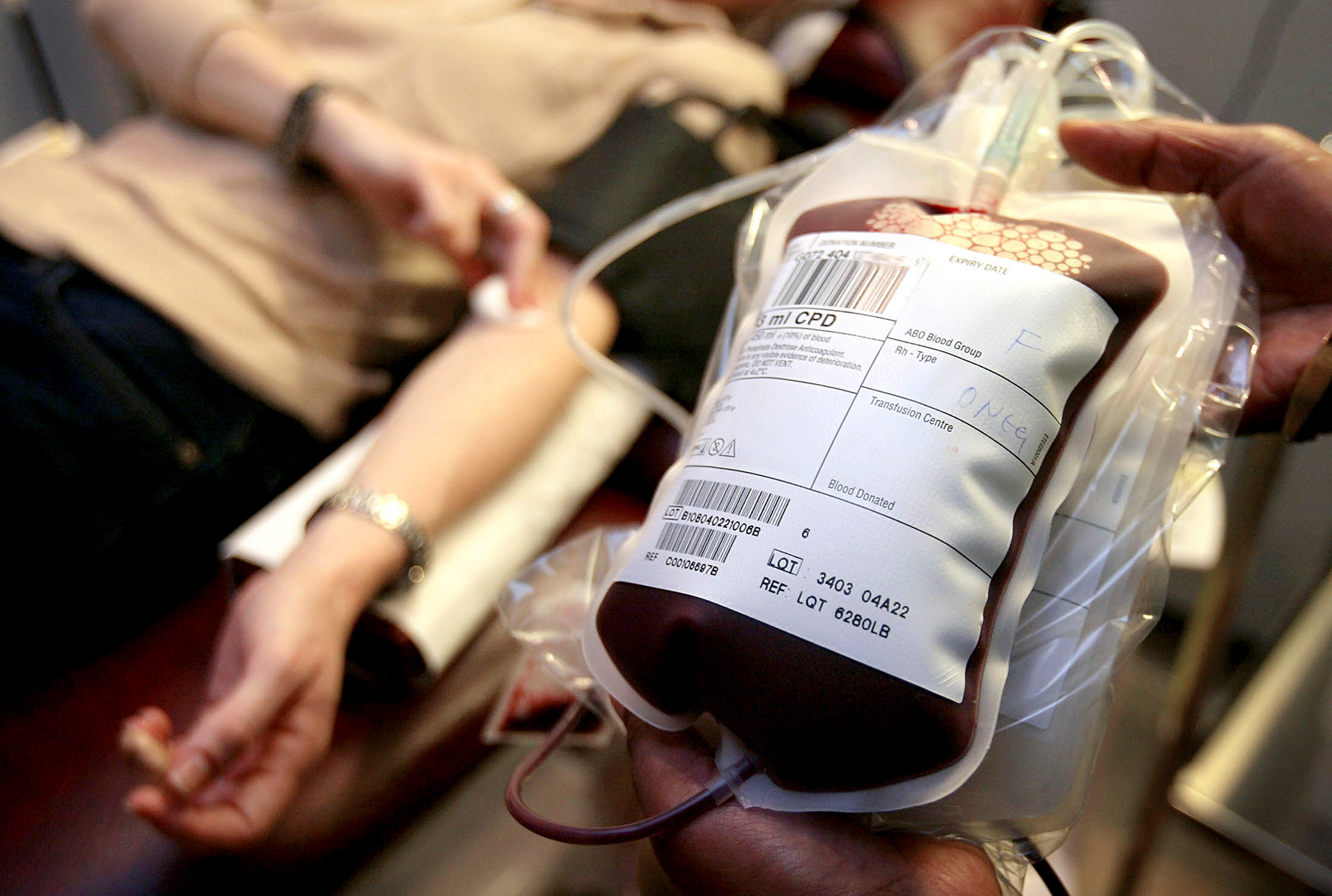 Переливание крови спасло жизнь. Процесс переливания крови. Непрямое переливание крови.
