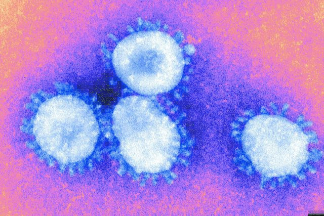KEELPNO on high alert after first case of MERS virus confirmed