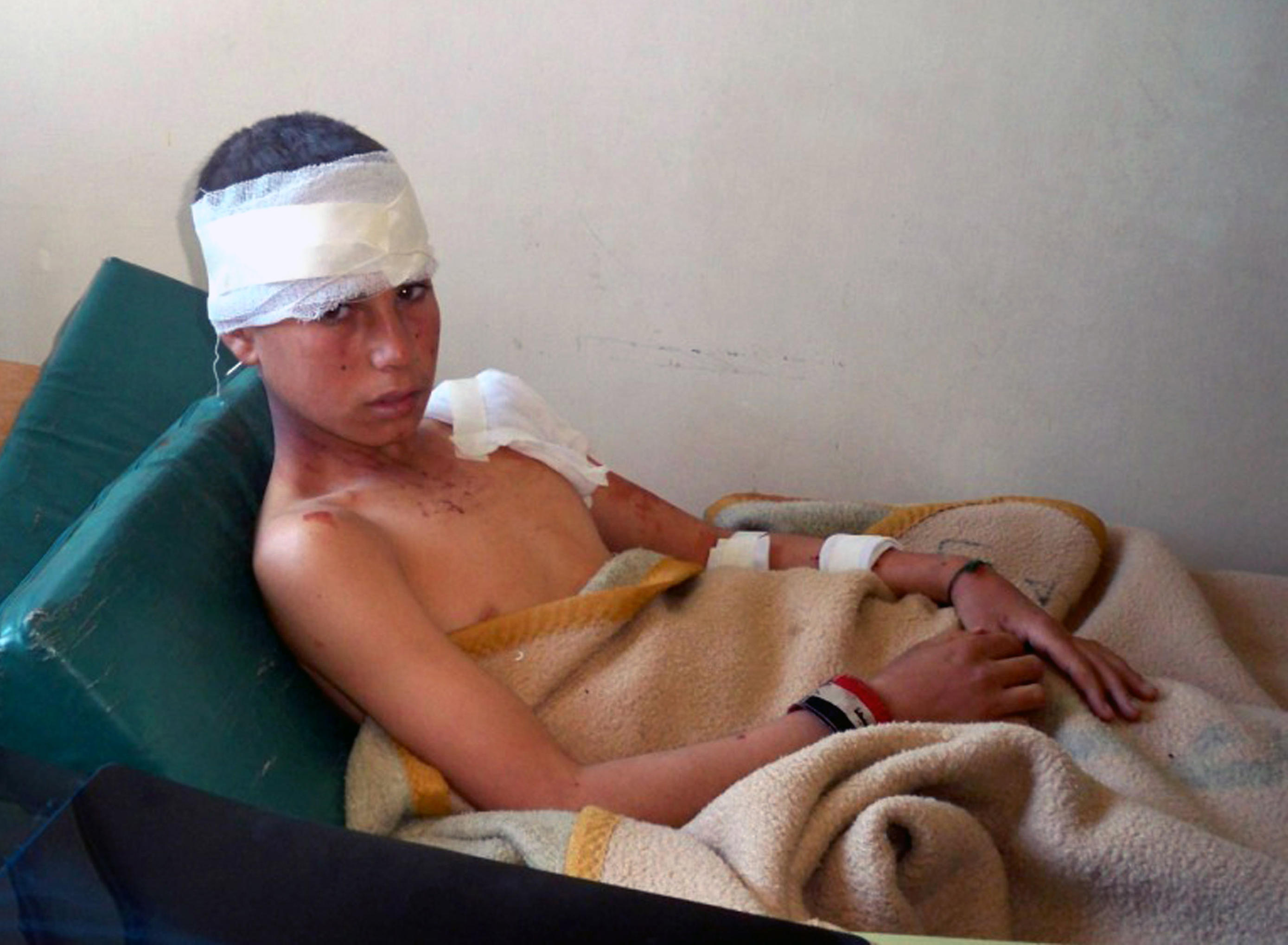 Συρία: 18 νεκροί μεταξύ των οποίων 11 παιδιά από επίθεση αυτοκτονίας