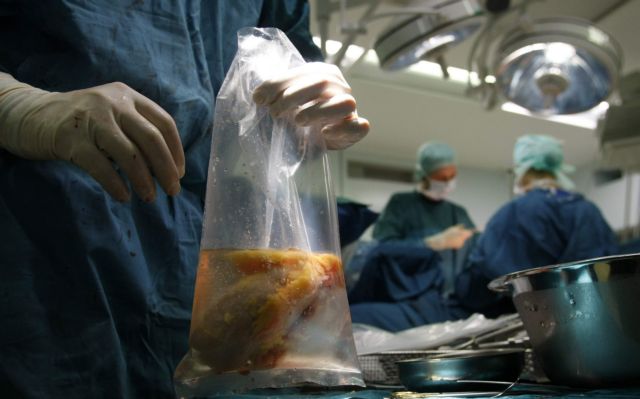 Δότες οργάνων όλοι οι Ελληνες