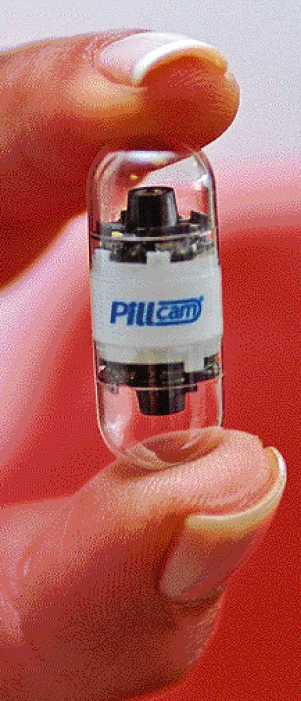 Pillcam: χάπι αντί κολονοσκόπησης