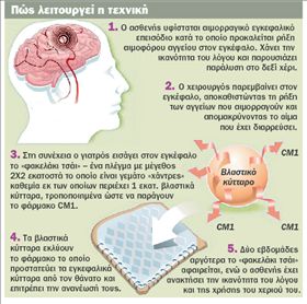 «Φακελάκι τσάι» αναστρέφει το εγκεφαλικό | tovima.gr