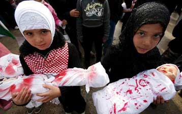 Στην Ελλάδα θα νοσηλευτούν τραυματισμένα παιδιά από τη Λωρίδα της Γάζας