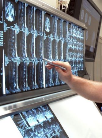 Τα κόλπα ιδιωτικών κλινικών και κέντρων με ακτινογραφίες και μαστογραφίες