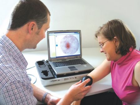 Πότε πρέπει να αφαιρούνται οι σπίλοι;