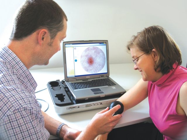 Πότε πρέπει να αφαιρούνται οι σπίλοι;