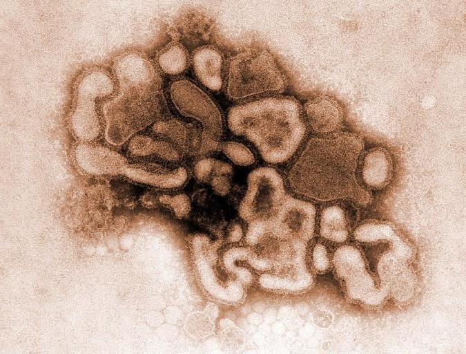 <b>Ισπανία: Επιβεβαιώθηκε το πρώτο κρούσμα γρίπης των χοίρων στην Ευρώπη</b>