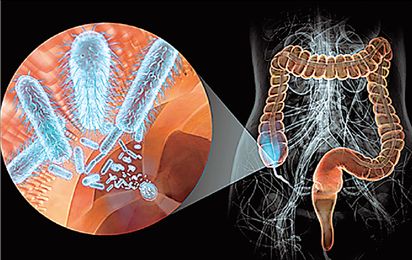 Η δικαίωση της… σκωληκοειδούς απόφυσης